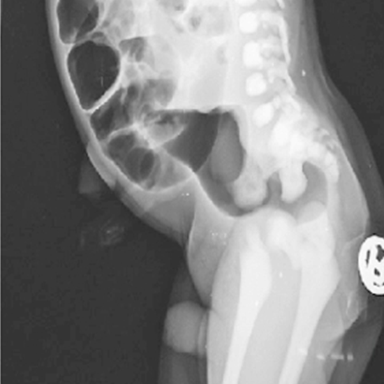 X-ray Abdomen Invertogram